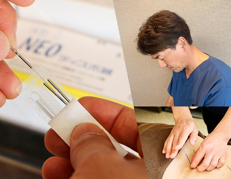 国立の鍼灸院マーノ