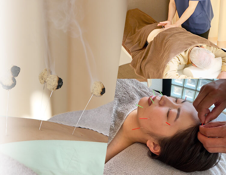 国分寺の鍼灸院