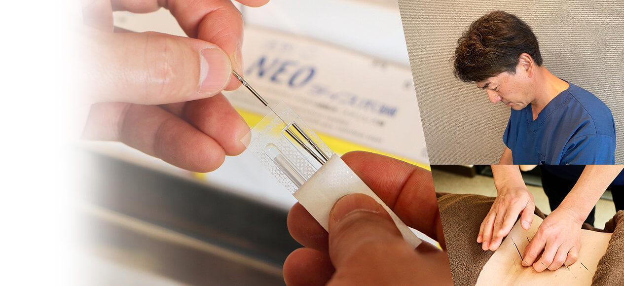 国立市・国立駅の鍼灸院マーノ